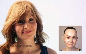 Medical Wigs - Alopecia Wigs - Davenport, IA - Moline, IL