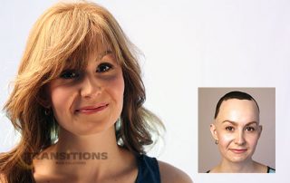 Medical Wigs - Alopecia Wigs - Davenport, IA - Moline, IL